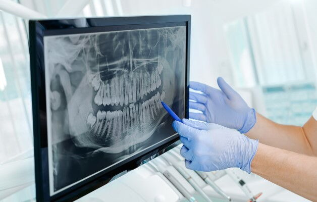 Das digitale Röntgen beim Zahnarzt stellt einen deutlichen Fortschritt im Bereich der zahnmedizinischen Bildgebung und Diagnostik dar