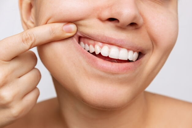Eine unbehandelte Zahnfistel kann schwerwiegende Konsequenzen für Ihre Mundgesundheit haben.