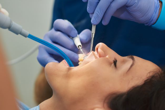 Durchführung einer professionellen Zahnreinigung