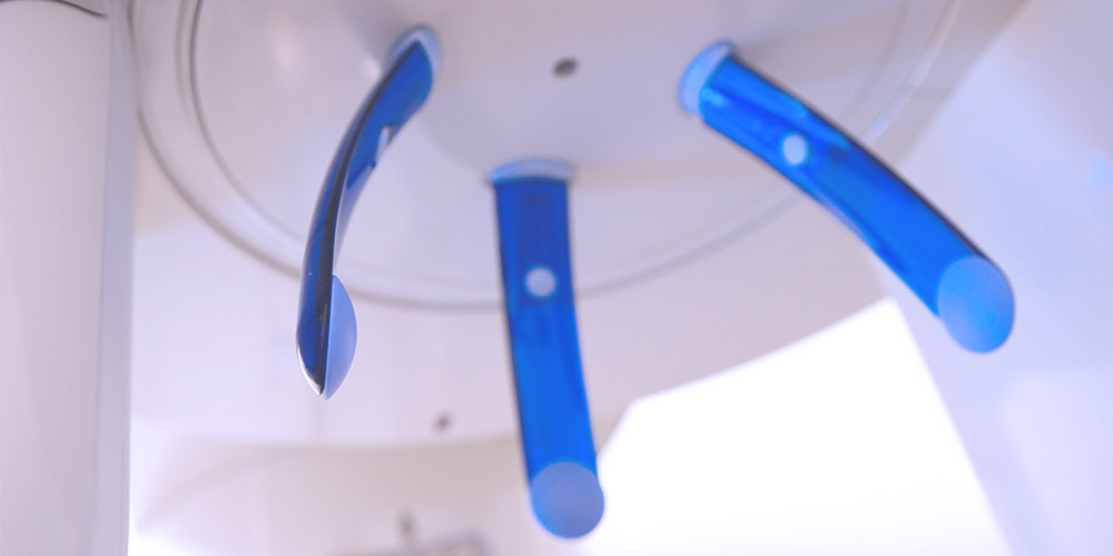 Das 3D-Röntgen bietet die Möglichkeit, bereits zu Beginn der Behandlung Implantate perfekt zu planen. 
