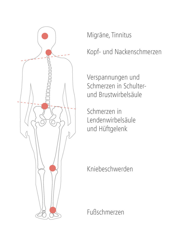 Die Symptome von CMD: Migräne, Tinnitus, Kopf- und Nackenschmerzen, Verspannungen, Schmerzen in Ledenwirbelsäule und Hüftgelenk, Kniebeschwerden, Fußschmerzen