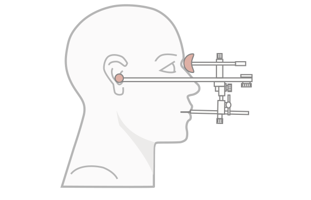 Illustration einer Funktionsanalyse
